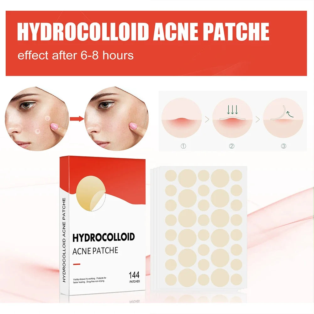 144pcs/set Face Skin Care Acne Pimple Patch 2 Sizes Invisible Professional Healing Absorbing Spot Sticker Covering for Men Women